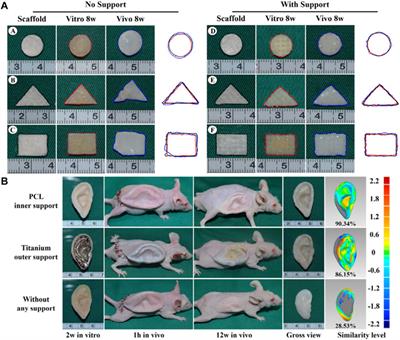 Biomaterials-based additive manufacturing for customized bioengineering in management of otolaryngology: a comprehensive review